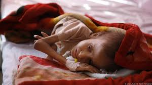 Yemen Acil Yardım